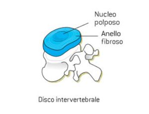 Disco Intervertebrale