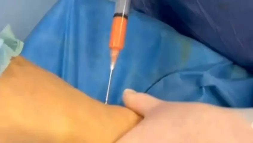 Rigenerare la cartilagine è possibile!